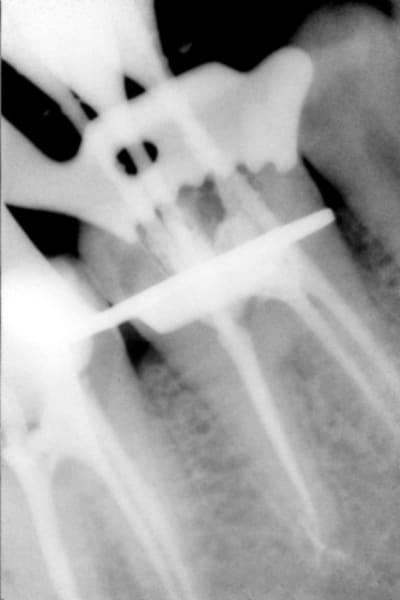 Endo 46 czlsam - Eugenol