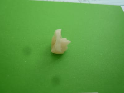Endo coiffe 002 gqe0zf - Eugenol