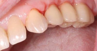 Essayage fsv5aj - Eugenol