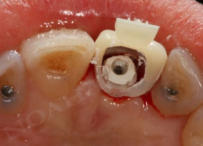 Essayage w5przm - Eugenol