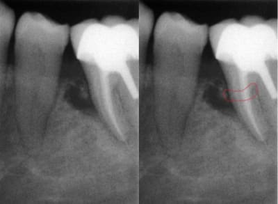 Eugenol 23 gv1hc2 - Eugenol