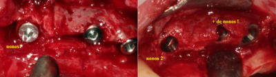 Expansion xavier hrqzch - Eugenol
