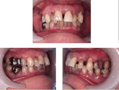 Ext ou pas dyyavo - Eugenol