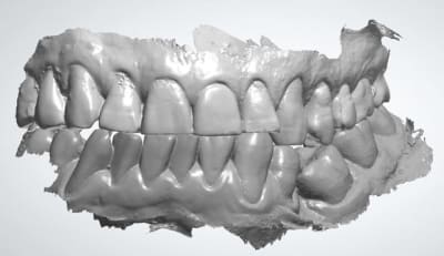 Face ctgcq1 - Eugenol