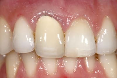Figure 5 vq5rxp - Eugenol