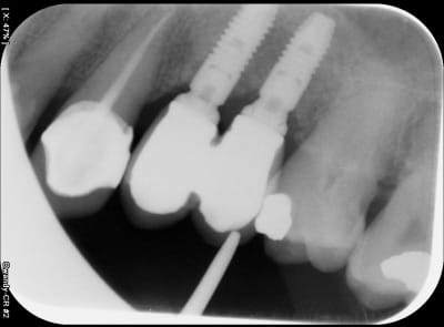 Fixe 3 lhu7f4 - Eugenol