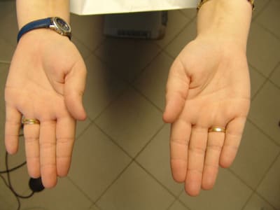 Fn4 nktxai - Eugenol