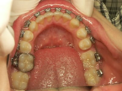 G  10  i4ojxg - Eugenol