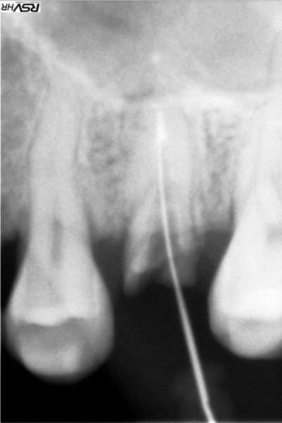 Gar1 apeugr - Eugenol