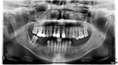 Gdooxhftoztvlw9w9l5v - Eugenol