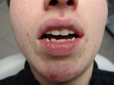 Gena h2fhxj - Eugenol