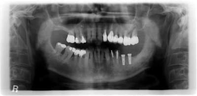 Gestion de stock i3btnu - Eugenol