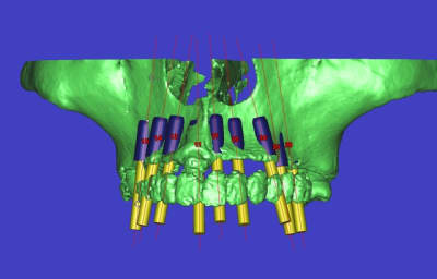 Giam 3d vpahrq - Eugenol