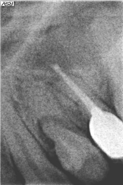Gnagne pvxq8x - Eugenol