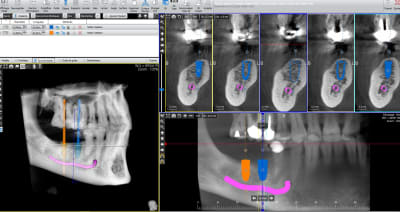 Gqr3md15pfo8juiuyxok - Eugenol