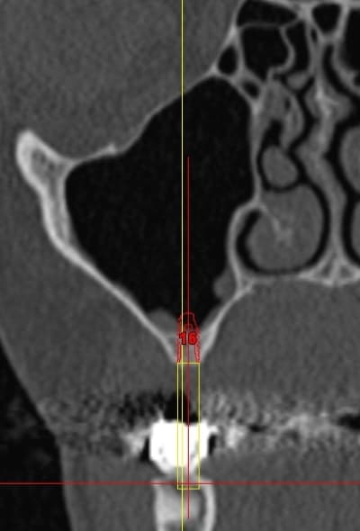 Gui m f 16 kxmkqm - Eugenol