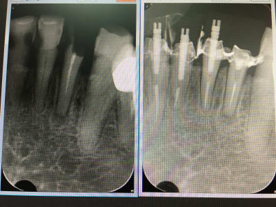 Hhhaqslsyifjdbtuh0en - Eugenol