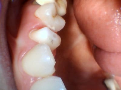 Hhwgec4t1burcpauffsp - Eugenol