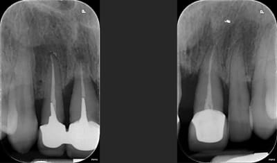 Hqrbhpsfbz923fxpkxe8 - Eugenol