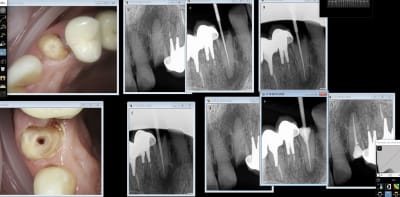 Hug 23 n5kqht - Eugenol