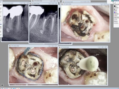 Hzfhpayvrdggenreebiw - Eugenol