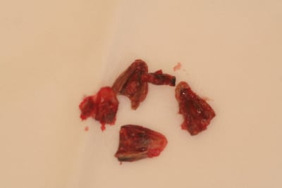 Ic 002 ammull - Eugenol