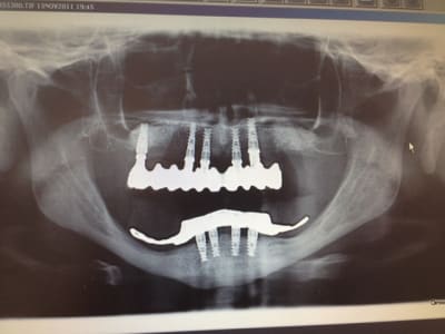 Image1 hmqteq - Eugenol