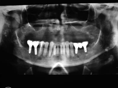 Image4 ukbltv - Eugenol