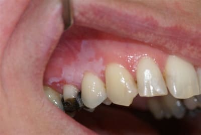 Image 14 uxdtjo - Eugenol