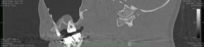 Image suspecte 2 - Eugenol