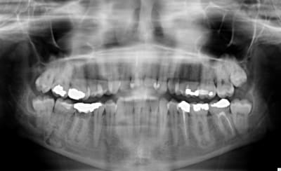 Imagebizarre zqtdqu - Eugenol