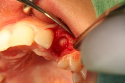 Img 0331 fh43ur - Eugenol