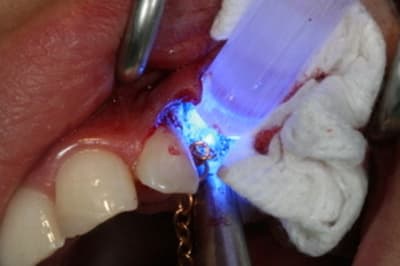 Img 0337 jyq1hw - Eugenol