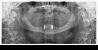 Impl trbz7t - Eugenol