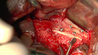 Instantan  001 pfvjo8 - Eugenol