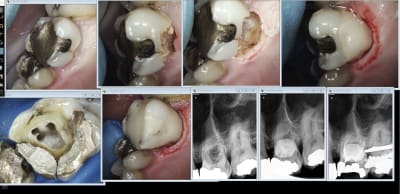 Iqmmli6zoyntviotps4m936c1uab - Eugenol