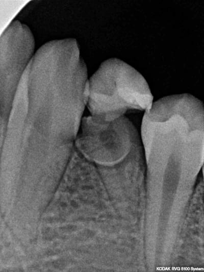 Ityom4yxctfxxv2stn0b - Eugenol