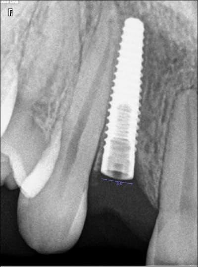 Ivfsvo0ergewtr4uisr0 - Eugenol