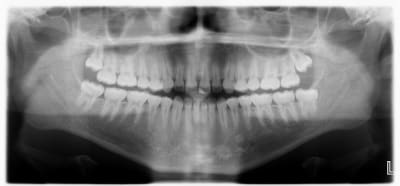 J1s9atx8rtfe8xjatwmg - Eugenol