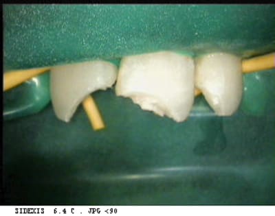 Jeris1 hcsxdw - Eugenol