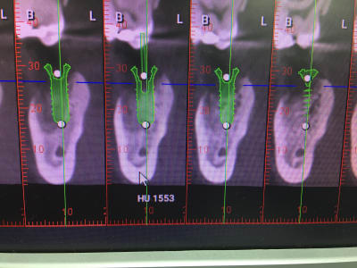Jiuxtygeukoacu6uftbd - Eugenol