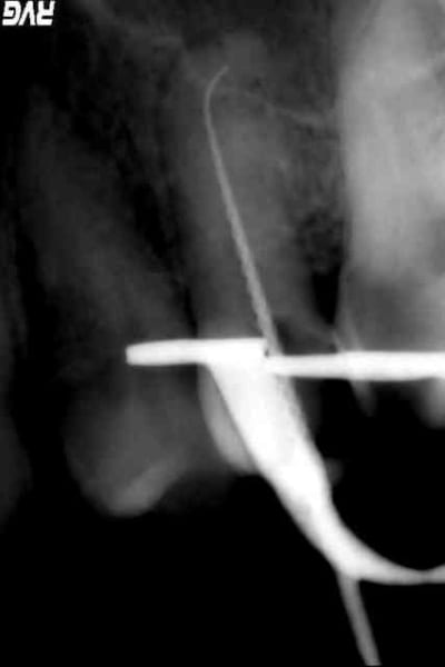 Jo3 lylikk - Eugenol