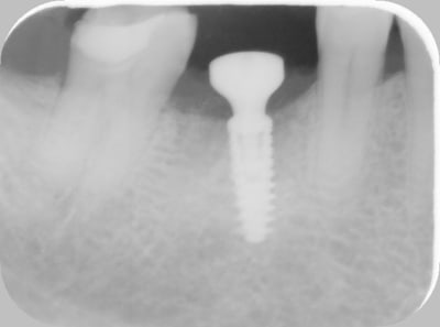 Jourdepose l8xemj - Eugenol