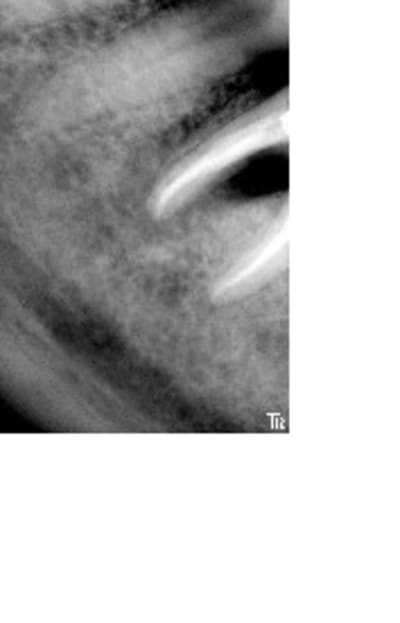 Jpostop1an1 w9jhg6 - Eugenol