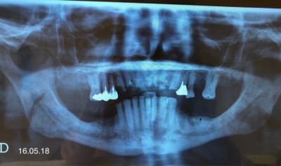 Jqw6pz9f5guszxcerb5w - Eugenol