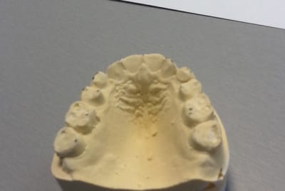 Kathy jxn4ix - Eugenol