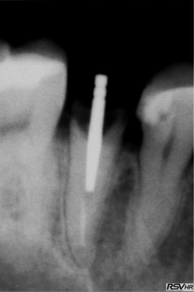 Ked1 ksnqqa - Eugenol