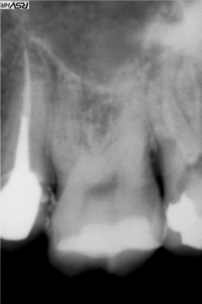 Ked2 x5lff0 - Eugenol