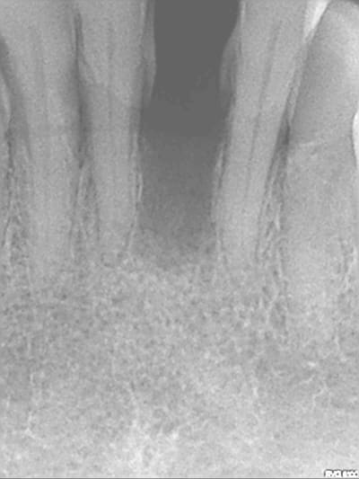 Kmflcqaypkt6uzkc78kl - Eugenol