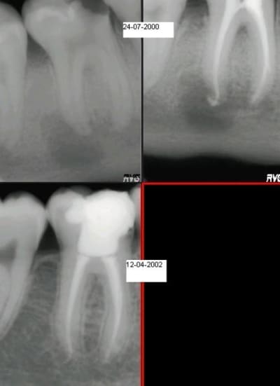 Koje 46 gd4xuh - Eugenol